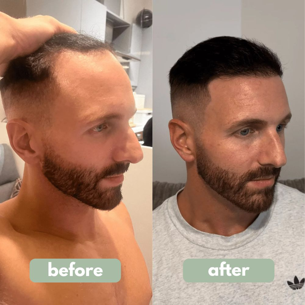 Hair Growth Serum Roll-On (New Formula)