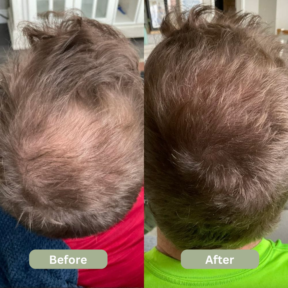Hair Growth Serum Roll-On (New Formula)